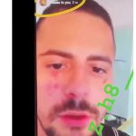 PREBIJEN BILAL BRAJLOVIĆ – unakaženo mu lice, zapomaže: “Joj, šta mi je uradila”